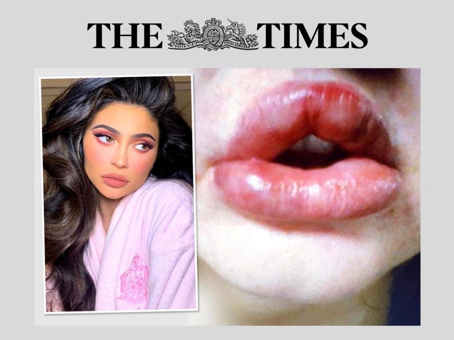 The Times Women regret botched lip fillers at home